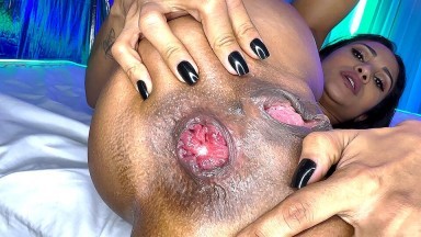 Une brésilienne souple fait ressortir le prolapsus de son cul